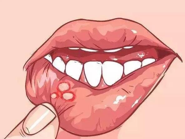 身體發(fā)出信號(hào)，你該補(bǔ)維生素了