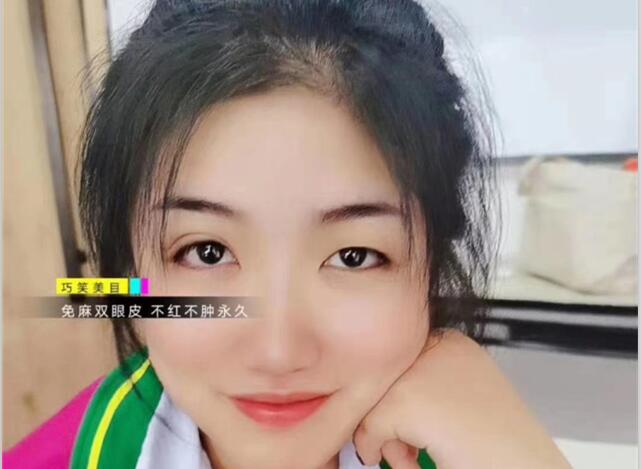 麗竹學(xué)?！凹y繡+雙眼皮”課程開講