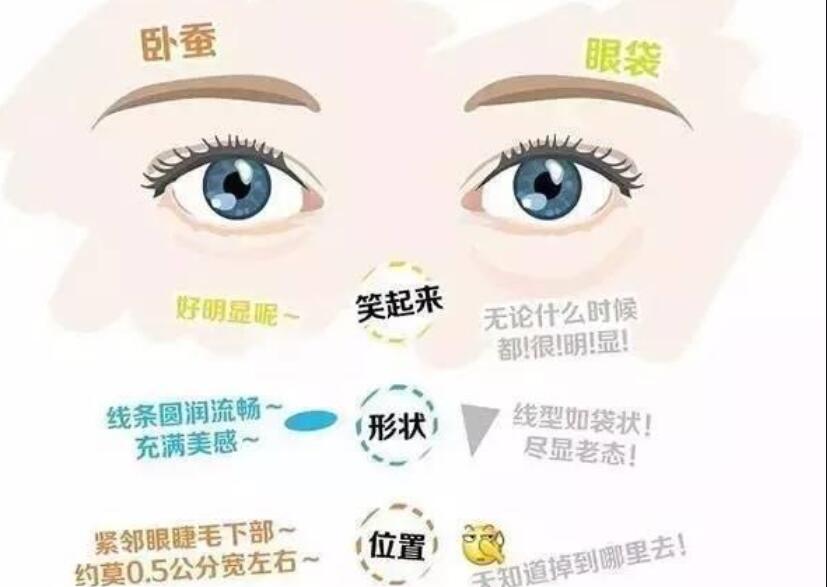 眼袋還是臥蠶，快來學(xué)辨別的方法