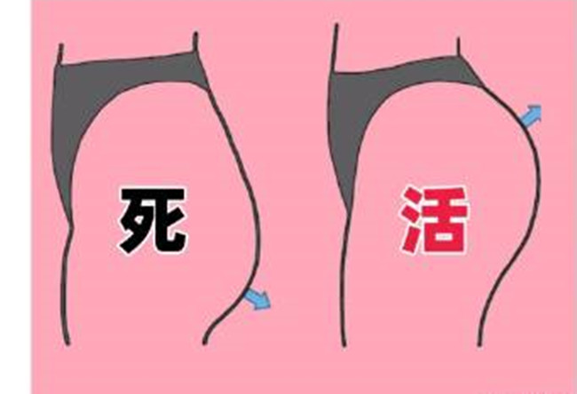 如何改善你臀部的健康情況？南寧美容形象